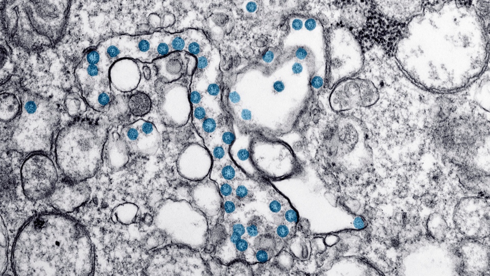 coronavirus microscope view