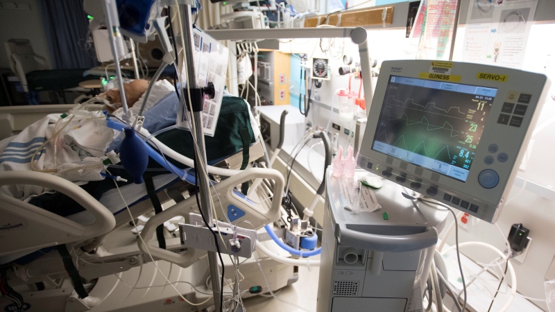 A patient is attached to a ventilator in the COVID-19 intensive care unit at St. Paul's hospital in downtown Vancouver, Tuesday, April 21, 2020. (Jonathan Hayward / THE CANADIAN PRESS)