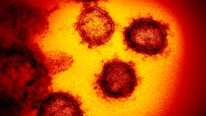 This undated electron microscope image made available by the U.S. National Institutes of Health in February 2020 shows the Novel Coronavirus SARS-CoV-2. THE CANADIAN PRESS/AP, NIAID-RML