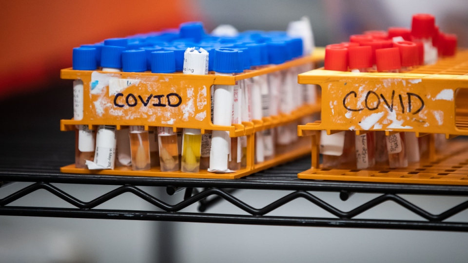 Specimens to be tested for COVID-19