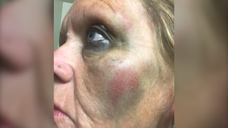 The victim told police that she was sitting on the beach when a stranger approached her, punched her in the face, then fled the area towards Telegraph Bay Road. (Submitted)