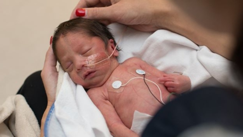 Twenty-seven babies were born at the Grey Nuns Community Hospital on Tuesday, July 28, 2020, setting an Edmonton record. (Facebook/Covenant Health)