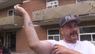 Shawn Willard shows bites on his arm he says are from an infestation of bed bugs and cockroaches in his apartment. (Stephanie Villella/CTV Kitchener) (Aug. 11, 2020)
