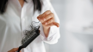 This stock image shows a woman's hair on her hairbrush. (ipopba / iStock)