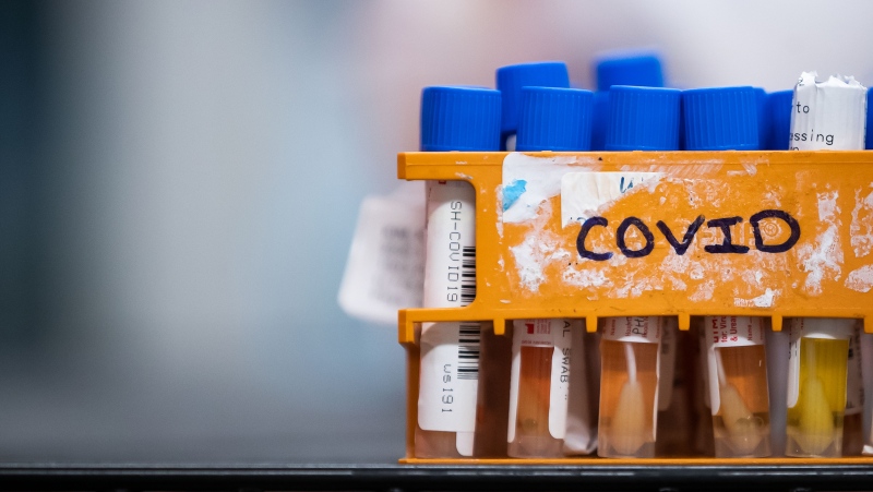 FILE - Specimens to be tested for COVID-19 are seen at LifeLabs after being logged upon receipt at the company's lab, in Surrey, B.C., on Thursday, March 26, 2020. THE CANADIAN PRESS/Darryl Dyck