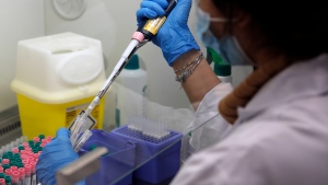 Seminar Kibir, health lab technician prepares chemicals to process analysis of some nasal swab samples to test for COVID-19 at the Hospital of Argenteuil, north of Paris, Friday Sept. 25, 2020. (AP Photo/Francois Mori)