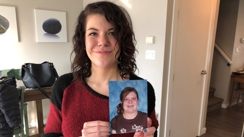 Brianna Bowyer is trying to raise $18,000 for skin-removal surgeries after the province denied coverage for her following her rapid weight loss. (Francois Biber/CTV Saskatoon)