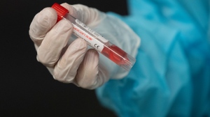 A nurse holds a vial containing a patients test swab during a demonstrates of the drive-thru Covid-19 testing centre at the National Arts Centre Wednesday November 18, 2020 in Ottawa. THE CANADIAN PRESS/Adrian Wyld
