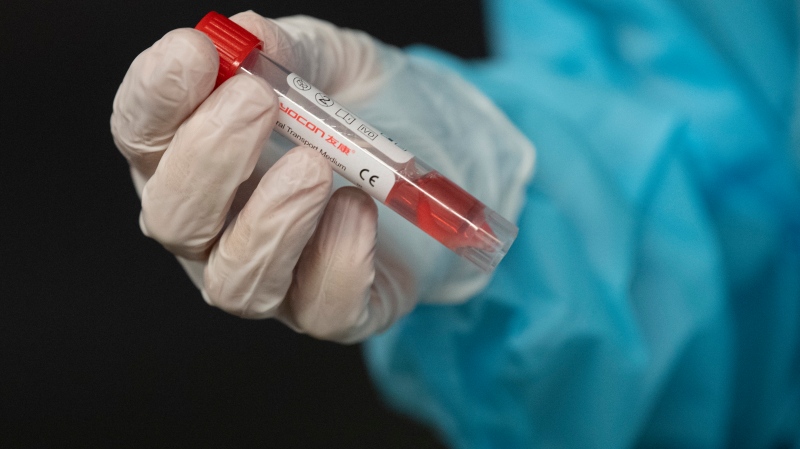 A nurse holds a vial containing a patients test swab during a demonstration of the drive-thru COVID-19 testing centre at the National Arts Centre Wednesday November 18, 2020 in Ottawa. (Source: THE CANADIAN PRESS/Adrian Wyld)