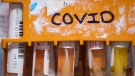 FILE - Specimens to be tested for COVID-19 are seen at LifeLabs after being logged upon receipt at the company's lab, in Surrey, B.C., on Thursday, March 26, 2020. (THE CANADIAN PRESS/Darryl Dyck)