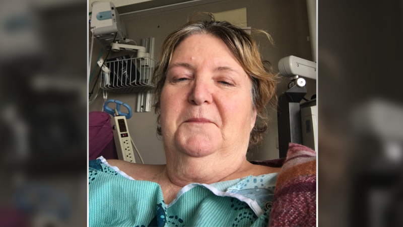 Gale Ramsden is recovering at the Ottawa Hospital after having her limbs amputated. (Photo courtesy: Gale Ramsden) 