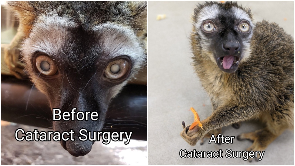 Lemur undergoes cataract surgery