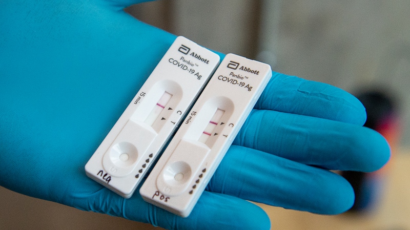 More than a dozen long-term care homes in Ottawa now have access to the Abbott Panbio COVID-19 rapid test, pictured here in this Nov. 25, 2020 image. (THE CANADIAN PRESS/Andrew Vaughan)