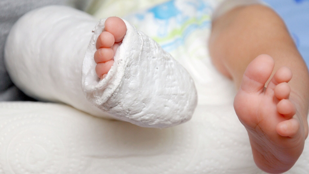 Injured infant