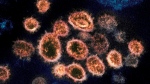 This 2020 electron microscope image provided by the National Institute of Allergy and Infectious Diseases - Rocky Mountain Laboratories shows SARS-CoV-2 virus particles which cause COVID-19. (NIAID-RML via AP)
