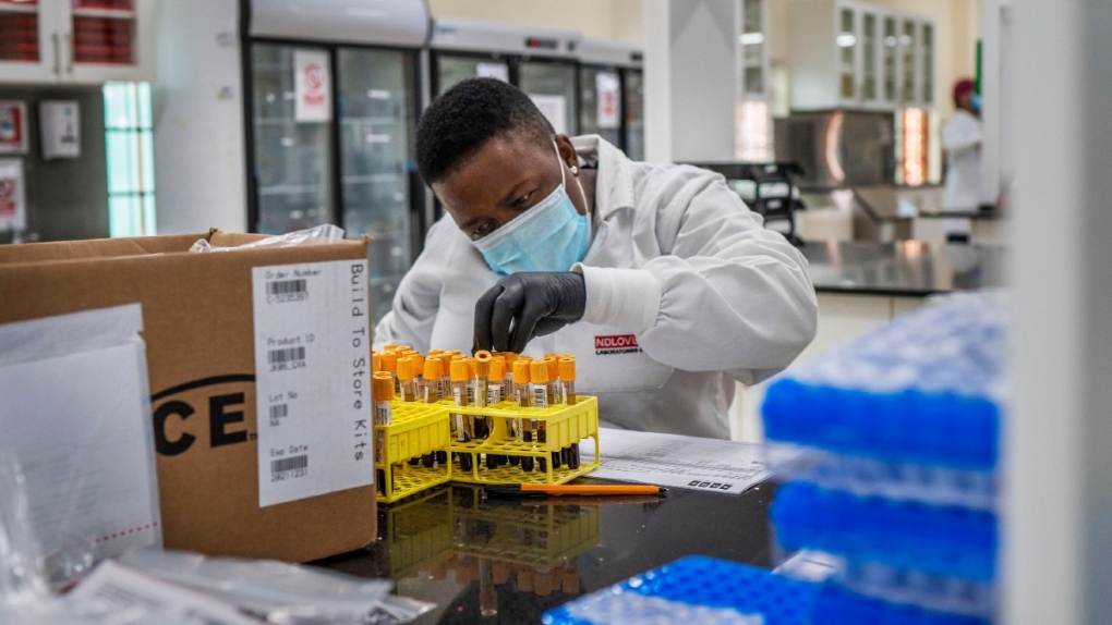 A lab technician works on blood samples