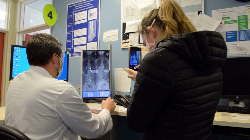 Olivia Koot, 17, takes a picture of the x-rays showing her spine before and after she underwent an innovative procedure for her scoliosis called ApiFix. (Photo courtesy: CHEO)