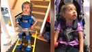 Rian is one of two Canadian girls who have received a new gene therapy for children suffering from 'pediatric Parkinsons', a rare disorder that makes children unable to support their own head and plagues them painful episodes that can last hours long. 