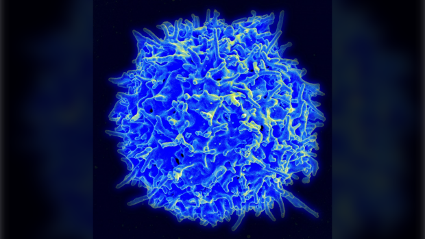 Coronavirus: Respons sel T kuat terhadap Omicron, kata penelitian