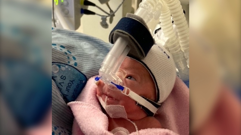 Hannah Kerr was born prematurely and remains in the neonatal ICU at Kingston General Hospital. Her father is raising money so that the hospital can by web cameras to allow families to see their little ones in the NICU any time of day. (Image courtesy of Pat Kerr) 