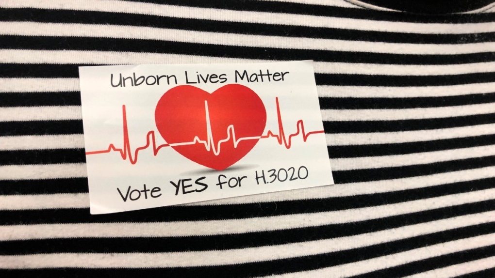 Fetal heartbeat' in U.S. abortion laws taps emotion, not science | CTV News