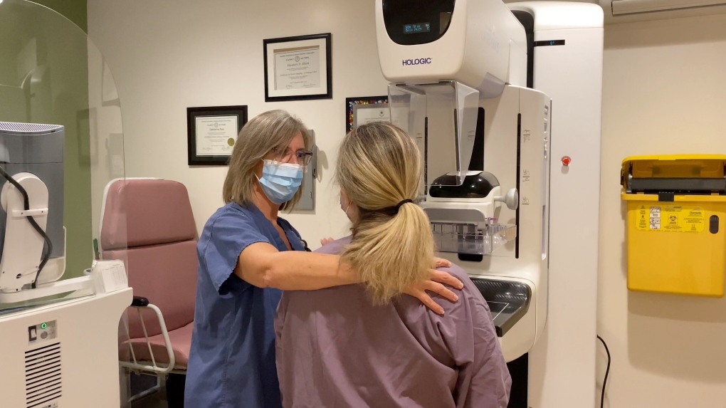 Mammography equipment 