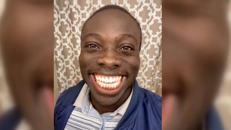 Borzah Yankey shows off his enormous grin on his TikTok channel, where other users duet his videos showing their own smiles in response. 