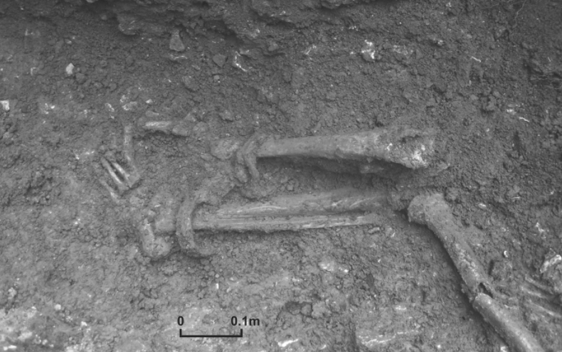 Great Casterton skeletal remains
