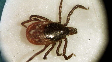 A female deer tick seen under a University of Rhode Island microscope in the entomoloy lab in South Kingstown, R.I. on March 18, 2002 (THE CANADIAN PRESS, AP - Victoria Arocho, File)