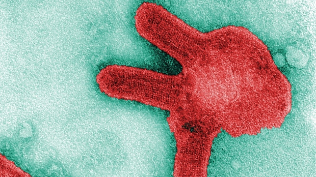 La Guinea conferma il primo caso di rara malattia da virus Marburg simile all’Ebola in Africa occidentale