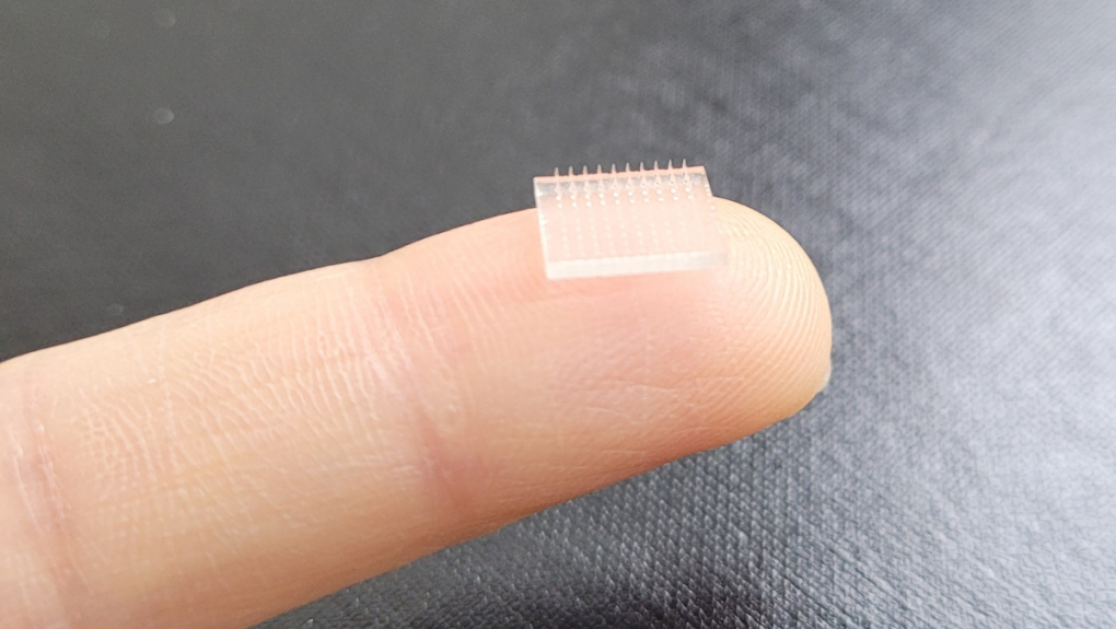 3D-printed vaccine patch