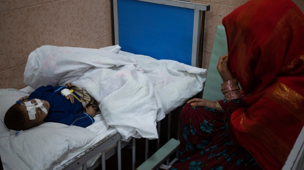 Afghanistan: Anak-anak kurus di rumah sakit Kabul