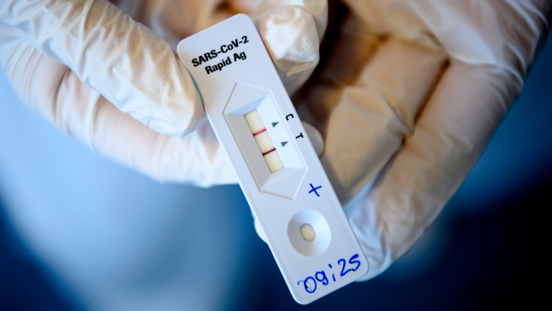 FILE - A health worker shows a positive 'SARS-CoV-2 Rapid Antigen' test just after collecting a nose swab sample for a polymerase chain reaction (PCR) at the coronavirus testing facility of Unisante, the university centre for general medicine and public health, in Lausanne, Switzerland, Monday, Nov. 9, 2020. (Laurent Gillieron/Keystone via AP)