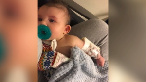 Baby Aviv has been sick with COVID-19 this week, worrying her parents -- something many families are going through as Omicron spreads. 