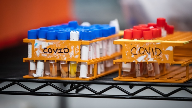 Ontario mengkonfirmasi 64 kematian terkait COVID-19 dengan 626 orang di ICU