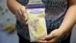 A woman poses for a photograph with her frozen breast milk in this file photo dated Wednesday, June 17, 2015, in West Chester, Pa. (AP Photo/Matt Rourke) 
