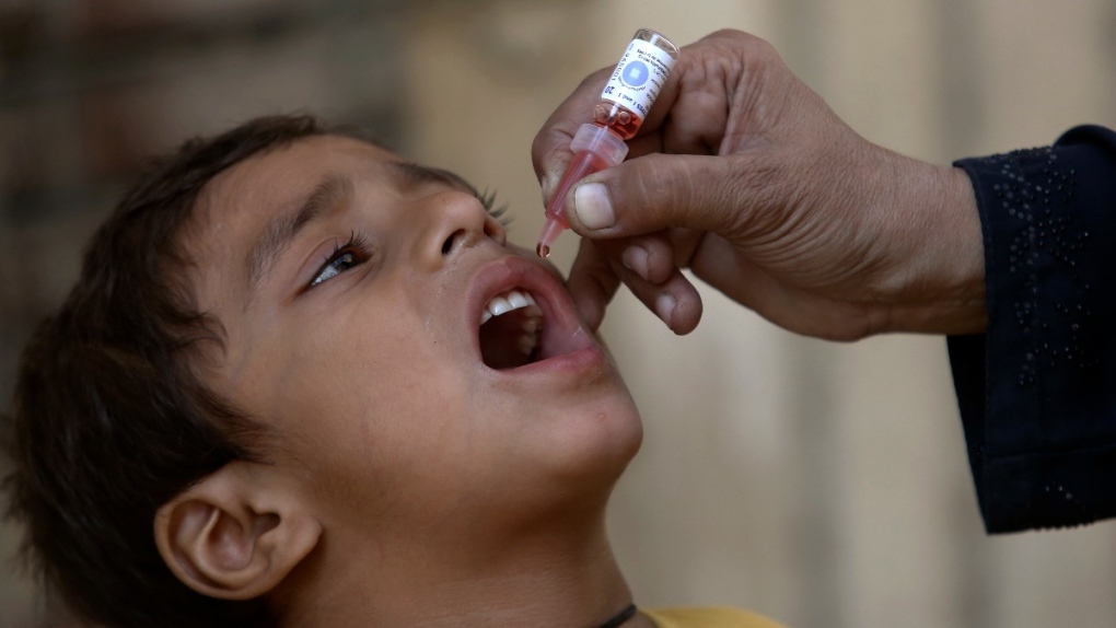Child gets a polio vaccine in Karachi, Pakistan
