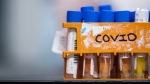 Specimens to be tested for COVID-19 are seen at LifeLabs after being logged upon receipt at the company's lab, in Surrey, B.C., on Thursday, March 26, 2020. THE CANADIAN PRESS/Darryl Dyck 