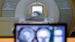 An MRI machine in an undated file photo. (AP Photo/Keith Srakocic, File)