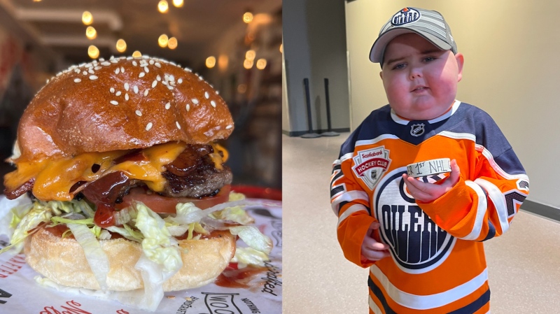 The Ben Burger (Source: The Woodshed) was created in honour of 5-year-old Ben Stelter (Source: Edmonton Oilers).