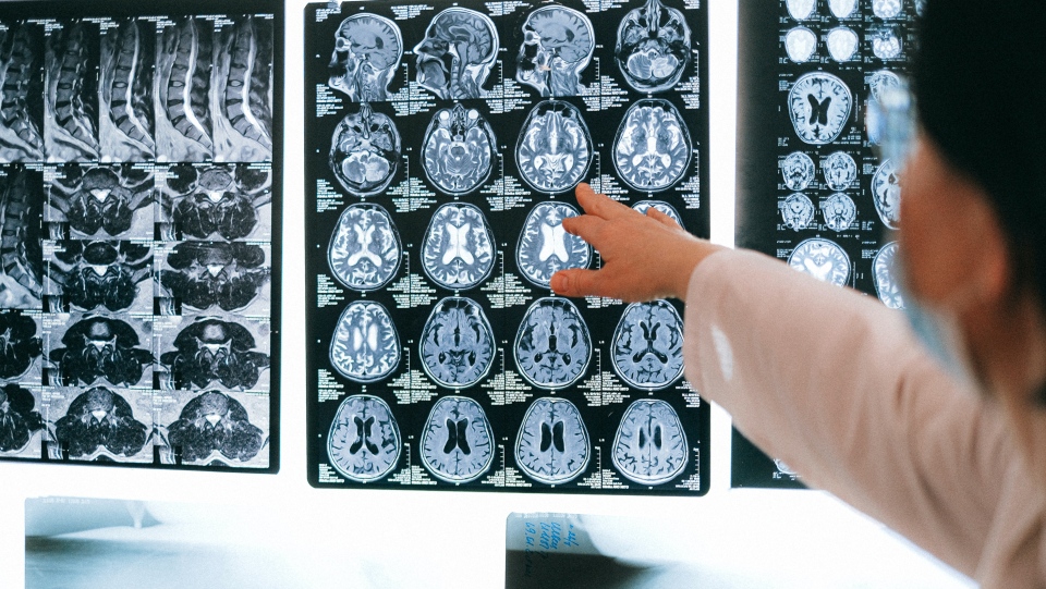 X-rays of brains