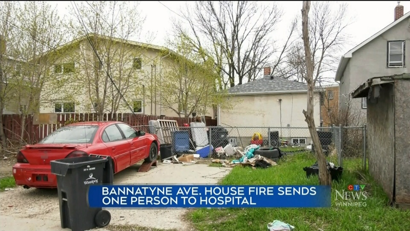 One person hospitalized in Winnipeg house fire