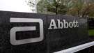 This Thursday, April 28, 2016, file photo shows a sign at an Abbott Laboratories campus facility in Lake Forest, Ill. Abbott Laboratories reports earnings Wednesday, Oct. 18, 2017. (AP Photo/Nam Y. Huh, File)