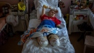 Anton Gladun, 22, lies on his bed at the Third City Hospital, in Cherkasy, Ukraine, May 5, 2022. (AP Photo/Emilio Morenatti)