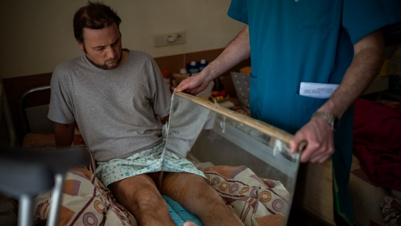Sasha Horokhivskyi, 38, performs mirror therapy to mitigate phantom pains at a public hospital in Kyiv, Ukraine, April 28, 2022. (AP Photo/Emilio Morenatti)