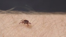 Keeping safe from ticks