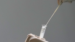 A health worker prepares a nasal test for a rapid COVID-19 test at a community medical centre in Brasilia, Brazil on Jan. 10, 2022. (AP Photo/Eraldo Peres)