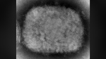 This 2003 electron microscope image made available by the Centers for Disease Control and Prevention shows a monkeypox virion, obtained from a sample associated with the 2003 prairie dog outbreak. Monkeypox, a disease that rarely appears outside Africa, has been identified by European and American health authorities in recent days. (Cynthia S. Goldsmith, Russell Regner/CDC via AP) 
