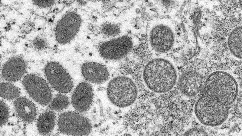 This 2003 electron microscope image made available by the U.S. Centers for Disease Control and Prevention shows mature, oval-shaped monkeypox virions, left, and spherical immature virions, right, obtained from a sample of human skin associated with the 2003 prairie dog outbreak. (Cynthia S. Goldsmith, Russell Regner/CDC via AP)