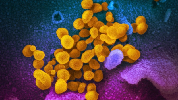 This undated electron microscope image made available by the U.S. National Institutes of Health in February 2020 shows the novel coronavirus SARS-CoV-2, yellow, emerging from the surface of cells, blue and pink, cultured in the lab. Also known as 2019-nCoV, the virus causes COVID-19. (THE CANADIAN PRESS/AP-NIAID-RML via AP)